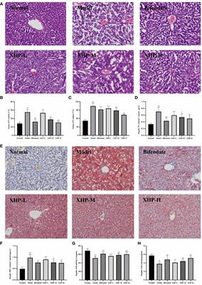Study of Xuanhuang Pill in protecting against alcohol liver disease using ultra-performance liquid chromatography/time-of-flight mass spectrometry and network pharmacology
